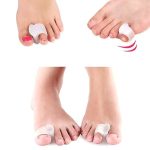 Toe Separators
